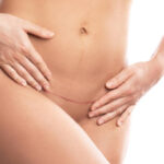 Can Femilift Restore Feminine Confidence