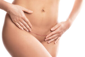 Can Femilift Restore Feminine Confidence