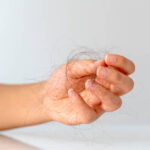 Can Hormones Affect Hair Loss & Nail Disorders