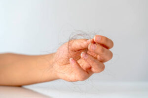 Can Hormones Affect Hair Loss & Nail Disorders