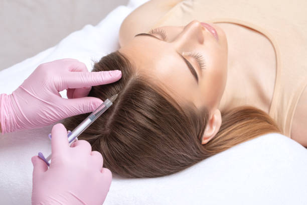 Can PRP Hair Treatment Restore Thinning Hairlines