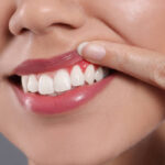 Can Sensitive Teeth Improve with Gum Treatment