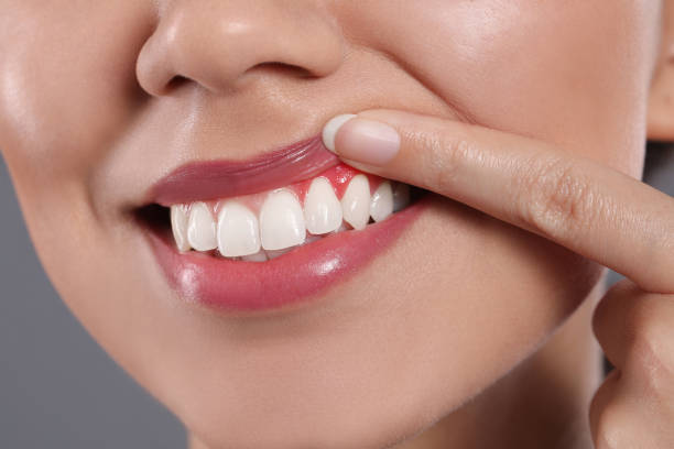 Can Sensitive Teeth Improve with Gum Treatment