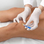 Do PRP Injections for Knees Improve Mobility