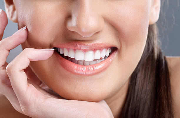 Does Teeth Whitening Work on Yellow Teeth