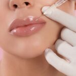Lip fillers in islamabad