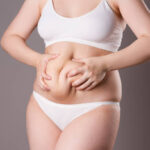 Why Is CoolSculpting Fat Freezing So Popular Now