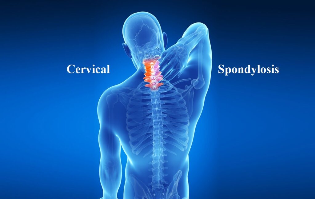 cervical spine issues