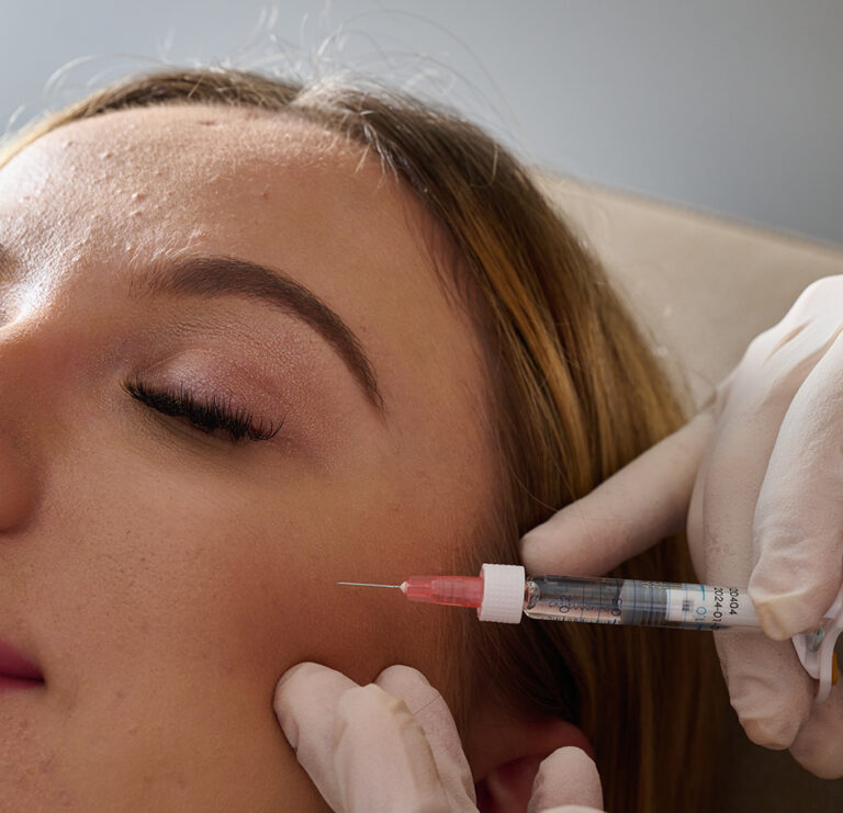 cheek dermal fillers