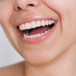 bone grafting surgery nyc