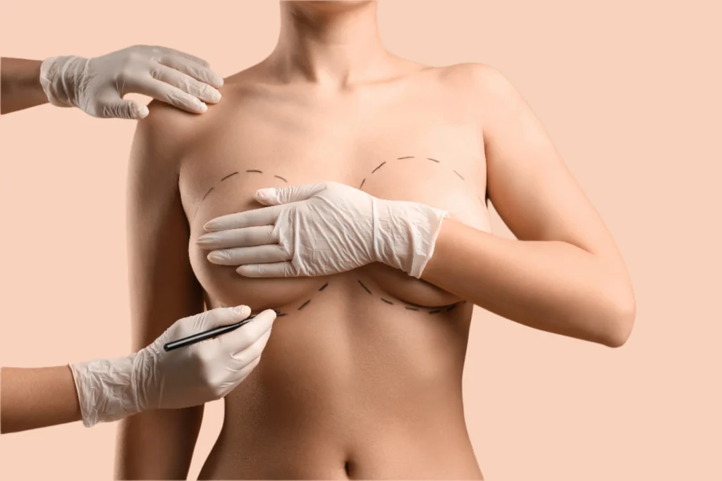 Breast Enlargement In Dubai