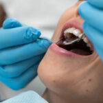 Can Full Mouth Rehabilitation Restore Confidence