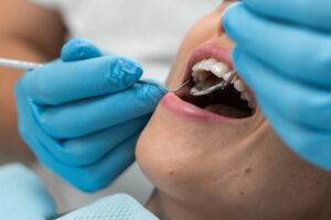 Can Full Mouth Rehabilitation Restore Confidence