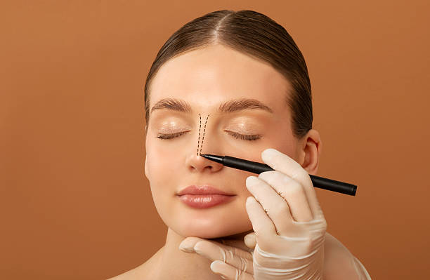 Can Rhinoplasty Improve Self-Confidence
