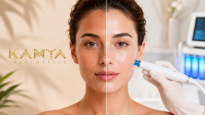 best Hydra Facial in Jaipur