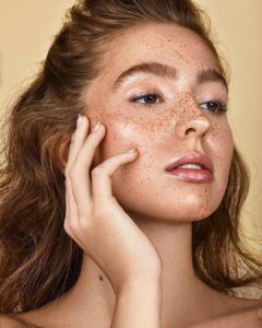 Does Melasma Treatment Work for All Skin