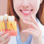 best dental implants nyc