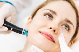 Is HydraFacial Worth It for Dry Skin Relief