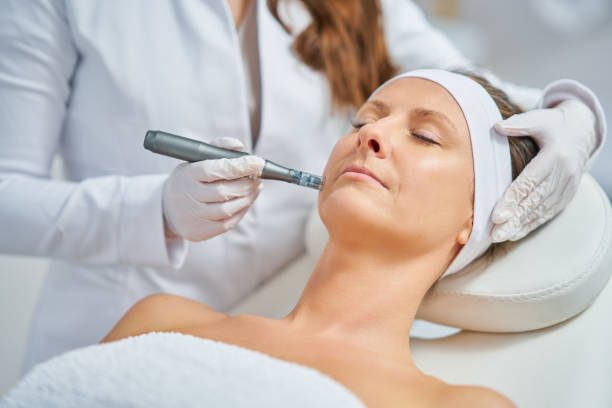 Is Microneedling Worth It for Skin Rejuvenation