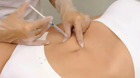 إبر الميزوثيرابي لإذابة الدهون