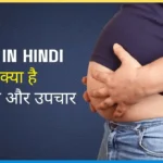 Obesity-in-hindi