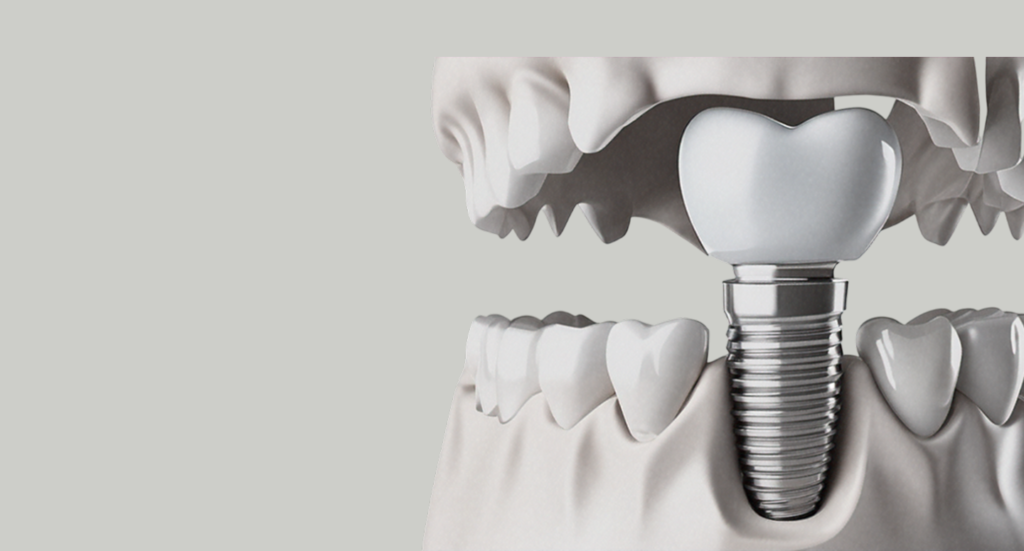 Surgical Guides -hero-SWdHXyjI