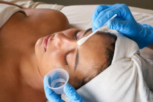 Chemical Peels Cost