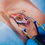 femto-lasik-1300x731 (1)