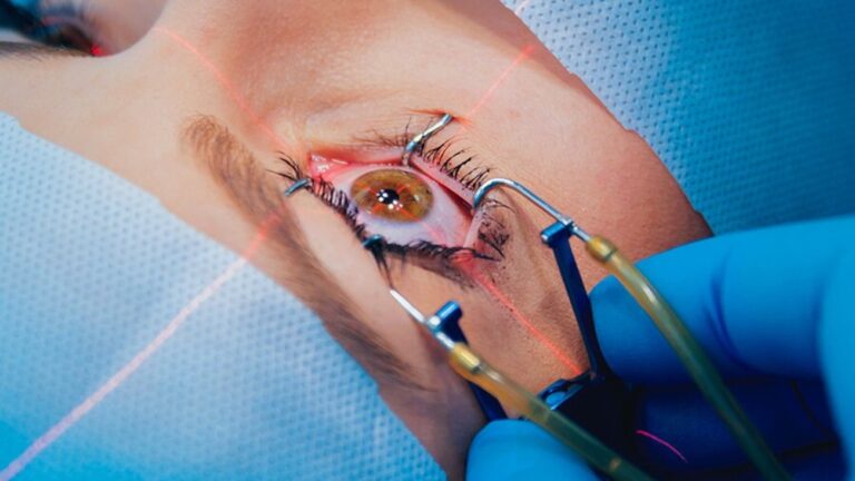 femto-lasik-1300x731 (1)