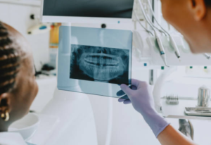 oral surgery caldwell