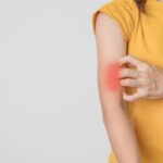 lupus rash vs rosacea symptoms explained