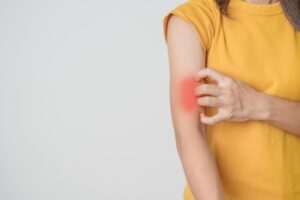lupus rash vs rosacea symptoms explained