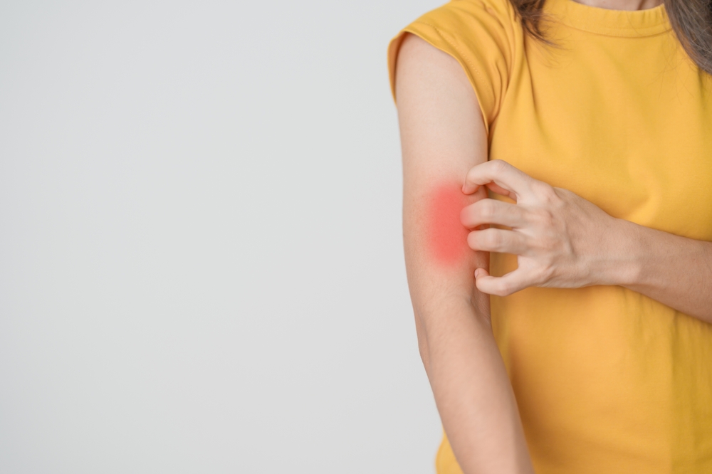 lupus rash vs rosacea symptoms explained