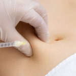 حقن مونجارو في دبي