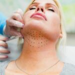 kybella san ramon