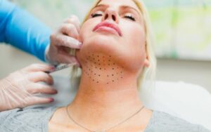 kybella san ramon