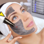 Can Laser Carbon Peel Remove Blackheads Fast