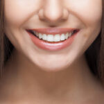 Can Teeth Whitening Fix Coffee-Stained Teeth