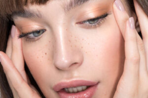 How Many Sessions Need for Melasma Treatment