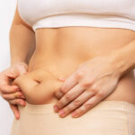 How Many Sessions of CoolSculpting Are Needed