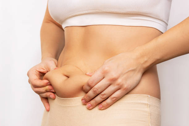 How Many Sessions of CoolSculpting Are Needed
