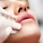 How Much Volume Is Ideal in Lip Fillers Injection
