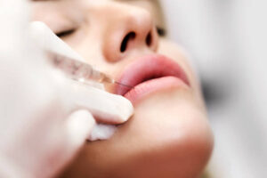 How Much Volume Is Ideal in Lip Fillers Injection
