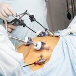 Laparoscopic surgery in Islamabad Pakistan