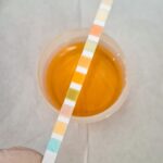 Trouble Urinating Treatment in Irvine, CA