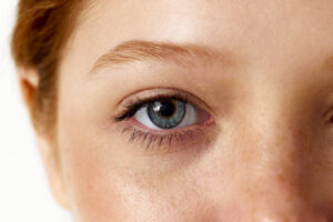 What Makes Eye Bag Removal a Trusted Treatment