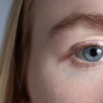 Why Is Eyelid Surgery So Popular Now