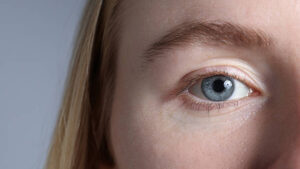 Why Is Eyelid Surgery So Popular Now