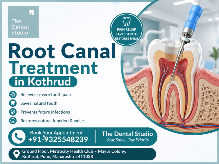 Root Canal Treatment in Kothrud