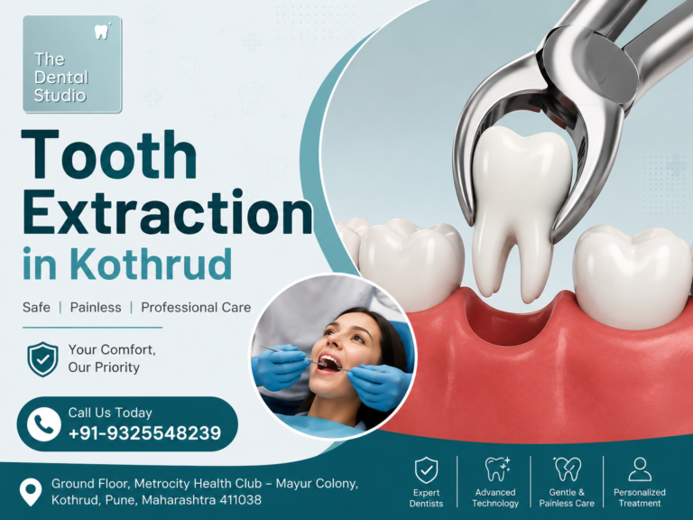Tooth Extraction in Kothrud